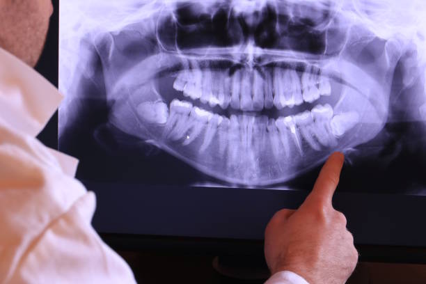 Best Cracked Tooth Emergency Dentist  in Wolfhurst, OH