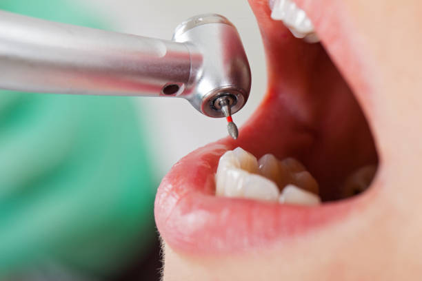 Best Urgent Dental Care  in Wolfhurst, OH